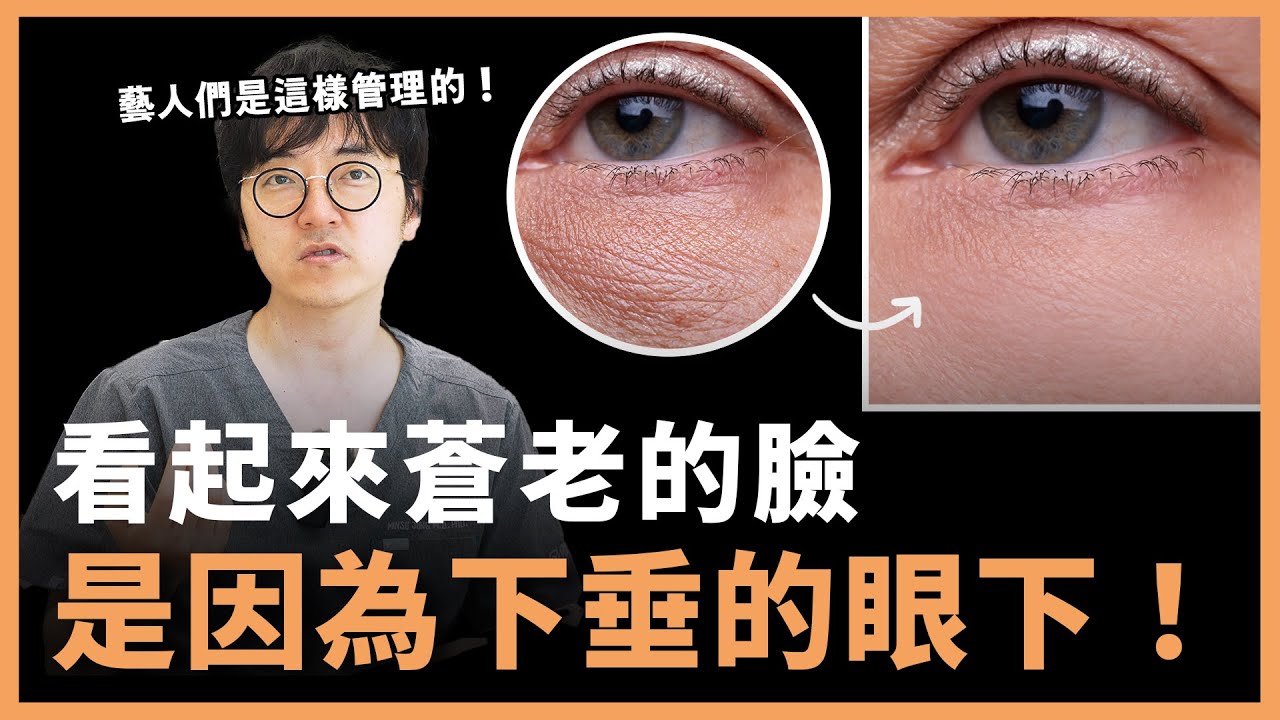 打造明亮雙眼！眼下微整形和手術的必看全攻略