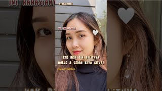 Download lagu 💥 SETELAH 1 TAHUN AKHIRNYA WAJAH KEMBALI MULUS !! 💥 mp3