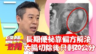 長期便祕靠偏方解決，大腸切除後只剩20公分？！【#醫師好辣】20211122 part3 EP1239 張心妍 陳炳諴