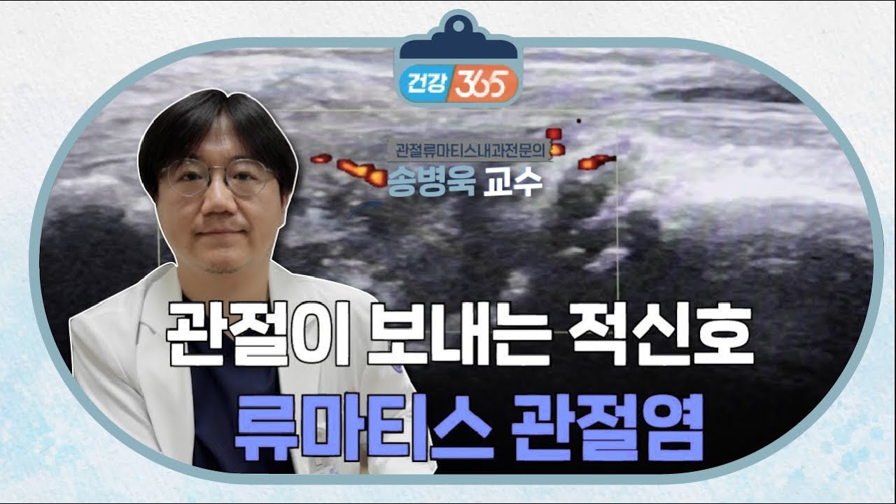 관절이 보내는 적신호, 류마티스 관절염 | 류마티스내과 송병욱 교수 관련사진