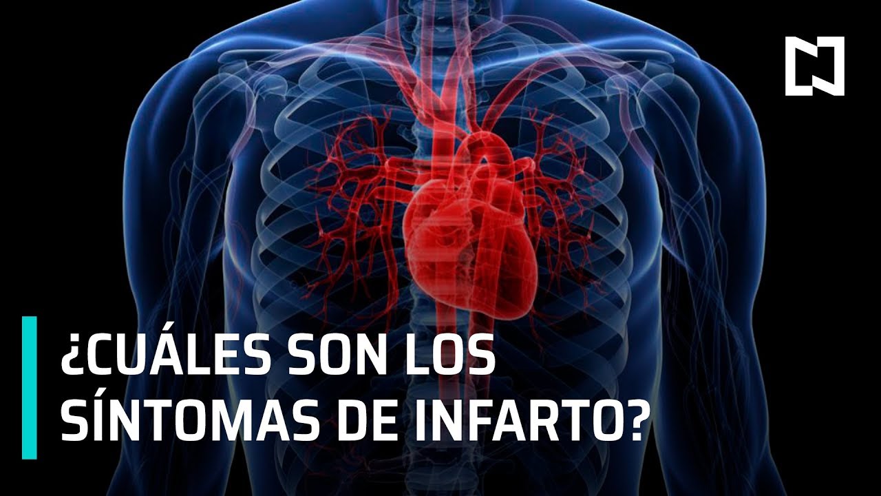 Síntomas de un infarto al corazón | Qué Hacer ante un Infarto al Corazón