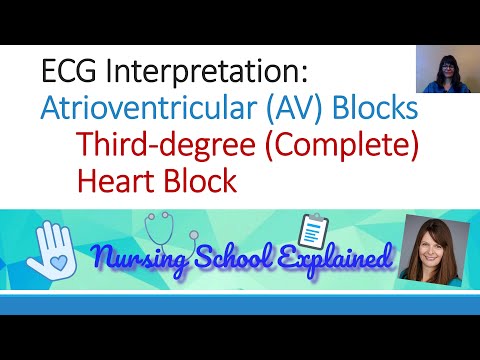 Third Degree/Complete AV (Heart) Block