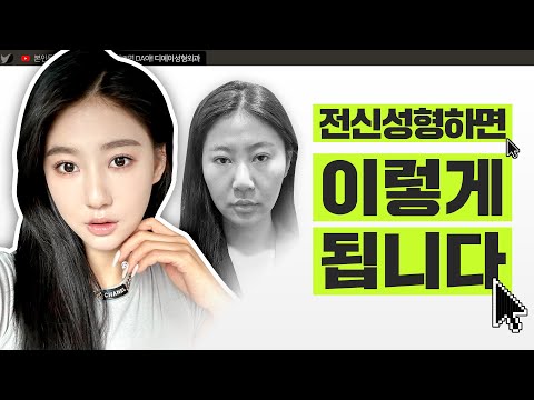 옆광대, 작은 가슴 한 번에 바꾸는 브이로그 l 윤곽3종+가슴+지방흡입 vlog