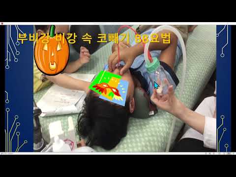 BB요법 치료 사례