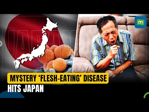 Japan’s Mystery Flesh-Eating Disease: Is It The Return Of Covid Like Era For The Country?