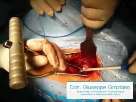 Perché orticaria rigidità articolare Ovulazione molto dolorante bassa della schiena