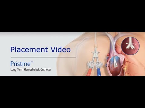 BD Pristine™ Long-Term Hemodialysis Catheter Procedural Animation (no audio)