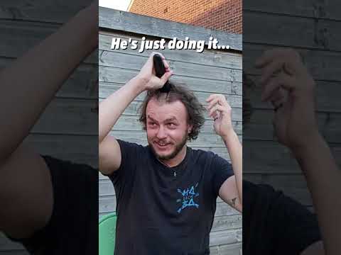 Thinning Hair - Winning Head #Transformation