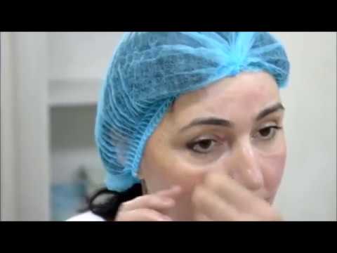 novi oko antihipertenziju