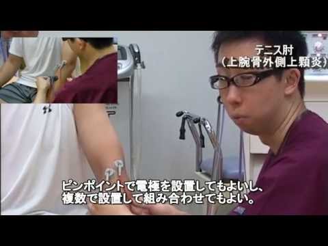 臨床現場における物理療法 第5部 テニス肘等