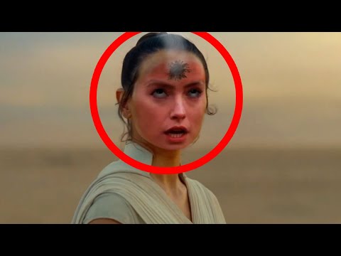 Rey gets shot in the head