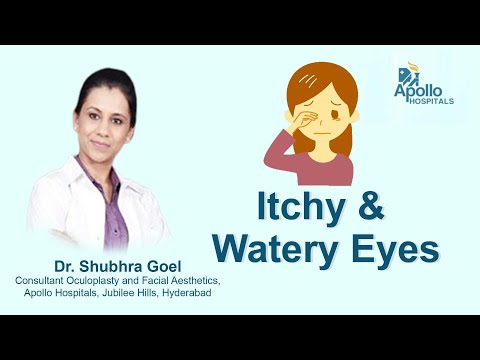 How to treat Itchy & Watery Eyes | Dr. Shubra Goel, Consultant Oculoplastic & Facial Aesthetics