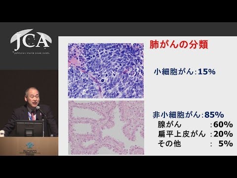栄養学科 講演1「個別化医療が開くがん診療の明日」 後藤 功一（国立がん研究センター東病院　呼吸器内科長）