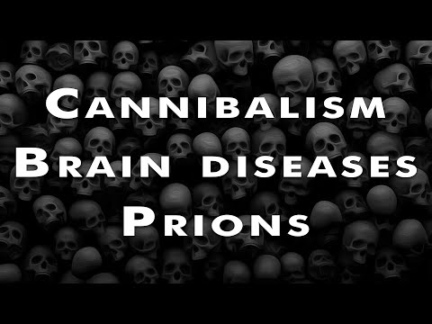 Prions and the disease of the dead.