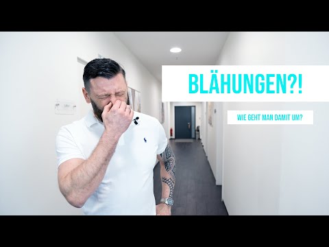 Blähungen - Was soll ich machen? (2020) | Dr. Eduard Karsten