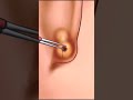 Earring hole clean animation process #asmr