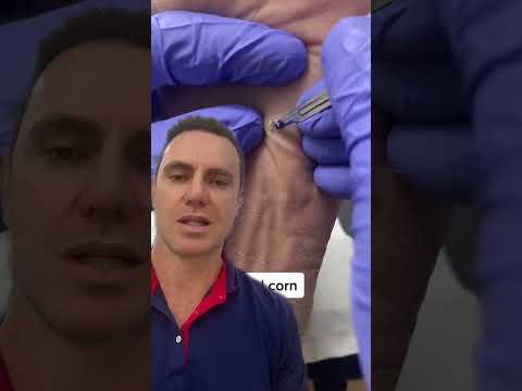 Transform Your Steps with Docpods Insoles Ultimate Comfort Revealed #FootCare #Docpods #Insoles