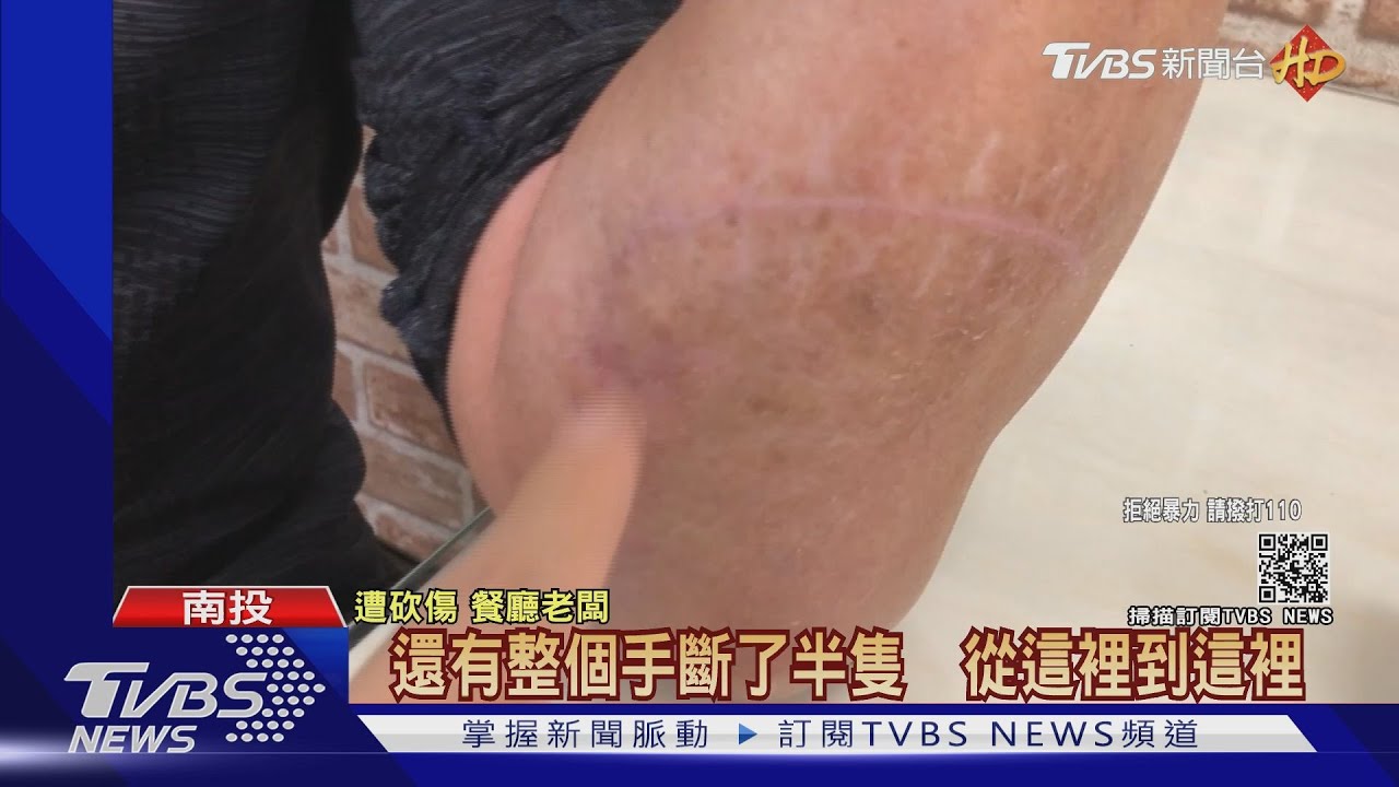 吃飯突遭砍多刀! 傷者不滿檢方僅傷害起訴
