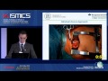 Short Term Results After Minimal Access AVR Using The EDWARDS INTUITY Valve System