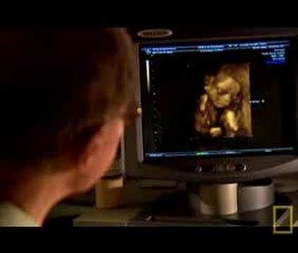 Click to Watch the The Divided State of America: How Long Can We Stand? video