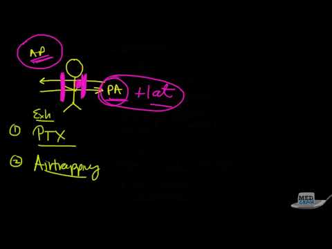 Chest X Ray Interpretation Explained Clearly   How to read a CXR