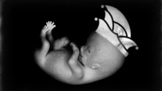 Miljö - De Welt noch nit jesinn - Offizielles Video