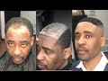 TRIED MICKEY DA BARBER CROCHET TECHNIQUE ON MALE ALOPECIA AREATA CLIENT | MY 1ST MALE HAIRCUT