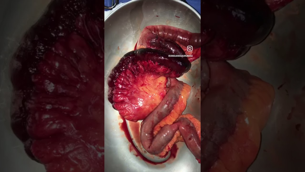 Luis Angel Medina Andrade-41