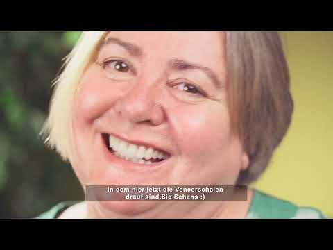TOSO 3 .  Zahnkrone , Veneers Vorher Nachher .  https://azzawizahnaesthetik.at