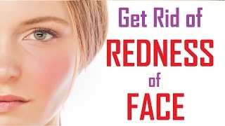 Top 15 Ways To Reduce Face Redness | How To Get Rid Of Redness On Face