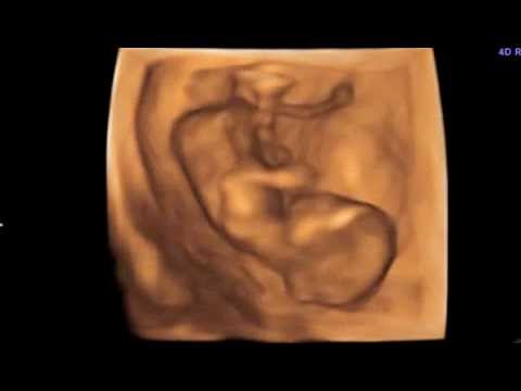 Fitoterapia malattia articolare Dolori di stomaco gravi si estende fino alla parte bassa della schiena
