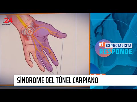 El Especialista responde: qué es y cómo afecta el Síndrome del túnel carpiano | 24 Horas TVN Chile