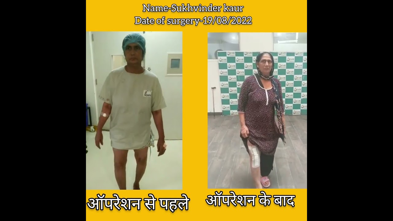 Knee Replacement Surgery - Pt name Sukhvinder Kaur #kneepain #drtarunsolanki
