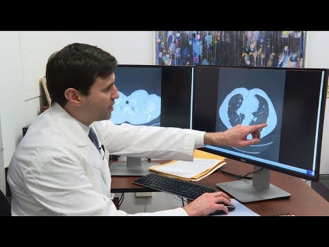 New paths to cure cancer emerge from immunotherapy trials