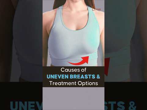 Causes of Uneven Breasts & Treatment Options | Asymmetry Breast #ytshorts