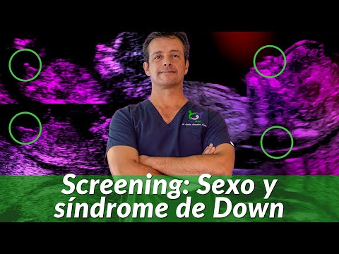 12 weeks pregnancy ultrasound [Sex and Down syndrome] First Trimester Screening