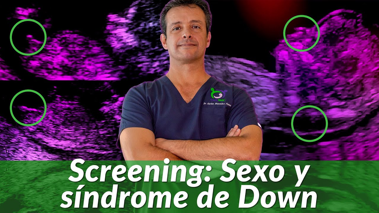 12 weeks pregnancy ultrasound [Sex and Down syndrome] First Trimester Screening