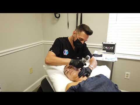 ProCell MicroChanneling 2020