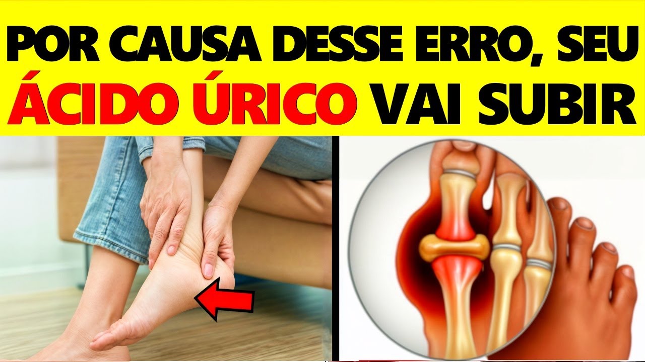 ALERTA! Este Alimento Está Aumentando Seu Ácido Úrico RAPIDAMENTE e ninguém te conta