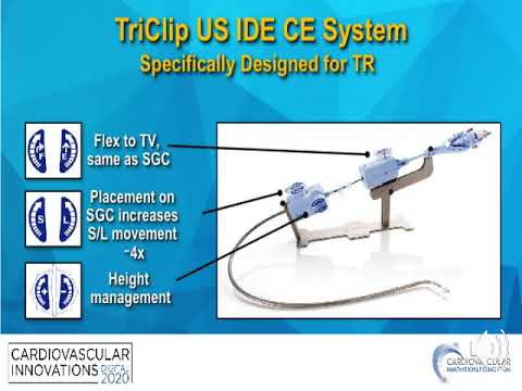 Edge to edge technique I_Sorajja_Structural On Demand
