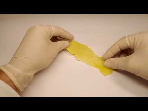 Zahntechnischer Workflow - Bicon: Teil 7 Kronenplatzierungshilfe