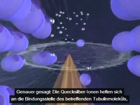 01 - Quecksilbervergiftung