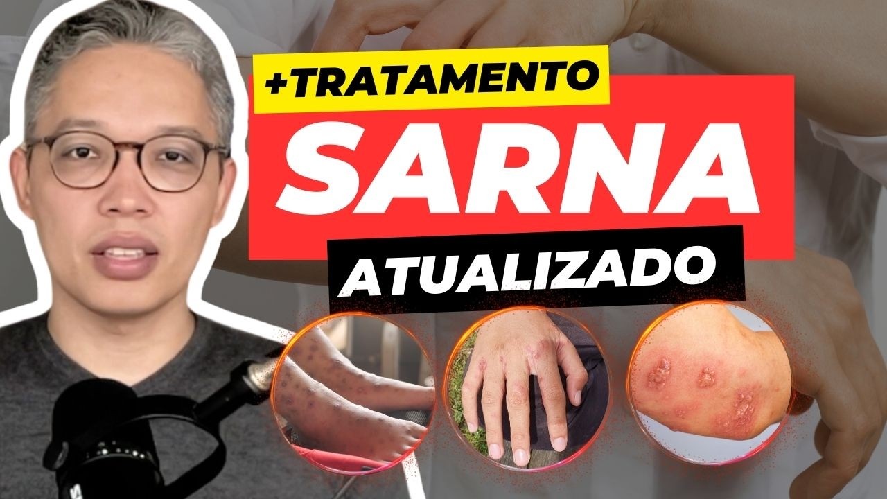 Como ELIMINAR a SARNA de forma Segura e Definitiva