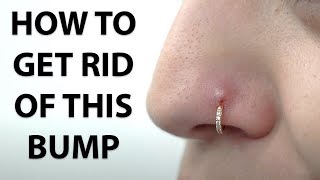 Everything You Need To Know About Piercing Bumps!!