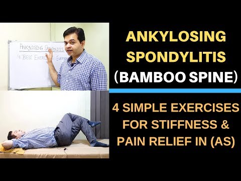 spondylitis ankylopoetica parazita leghosszabb parazita az emberekben