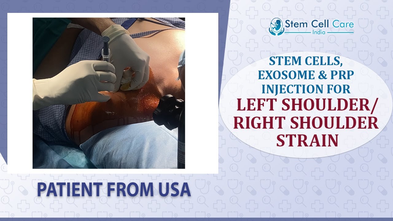 Intra-Articular Injection Procedure—Joint Restoration Using Stem Cells, Exosomes & PRP
