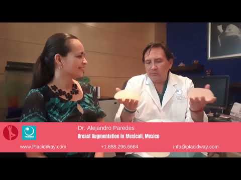 Breast Augmentation in Mexicali, Mexico by Dr. Alejandro Paredes