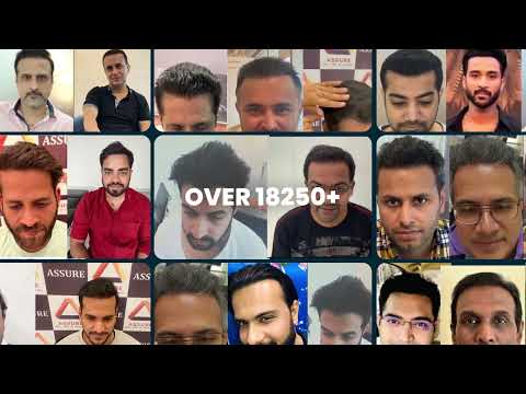 Why Assure is the top Hair Transplant Clinic? Watch...