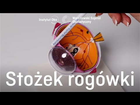 Stożek rogówki- Warszawski Szpital Okulistyczny i Instytut Oka