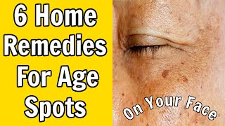 6 Home Remedies For Age Spots on The Face